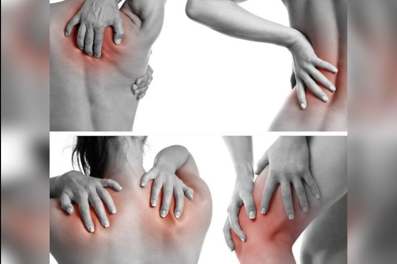 FIBROMIALGIA