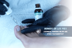 Lee más sobre el artículo Hongo en los pies » tratamientos que funcionan